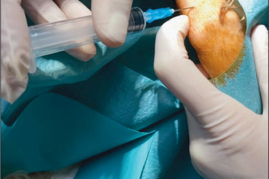 Figure 2. Stifle arthrocentesis.