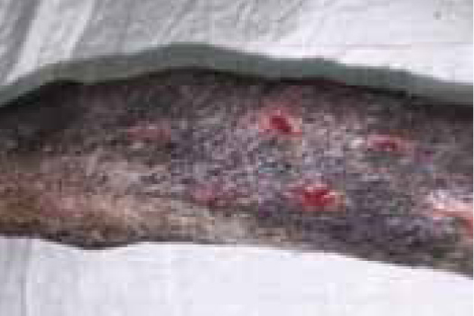 Figure 9c. Good healing and contraction of the relaxing incisions by day 12 post operatively.