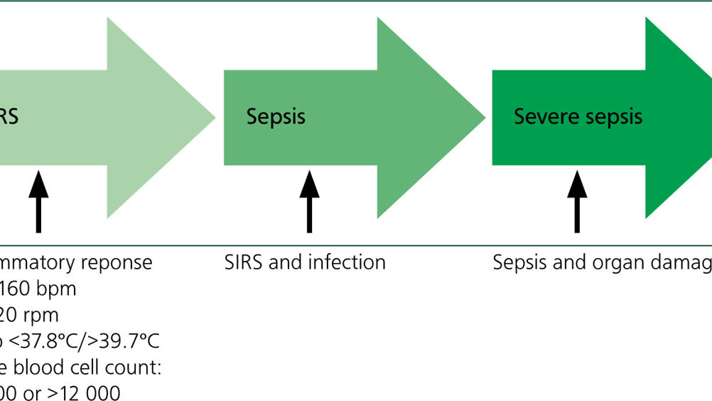 Figure 1. Disease process from trauma to septic shock (adapted from Mittleman Boller and Otto (2009); Breton (2012)). SIRS, systemic inflammatory response syndrome; HR, heart rate; RR, respiration rate.