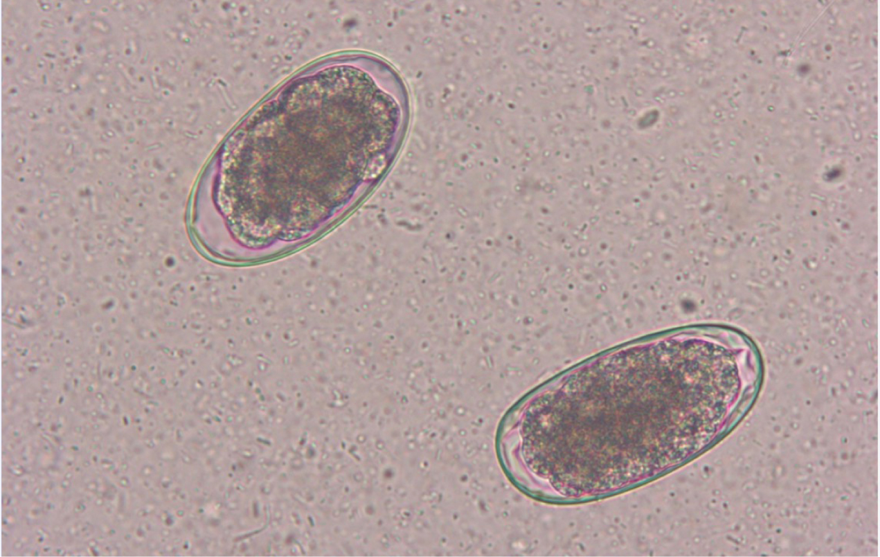 Hookworm and roundworm treatment outlet