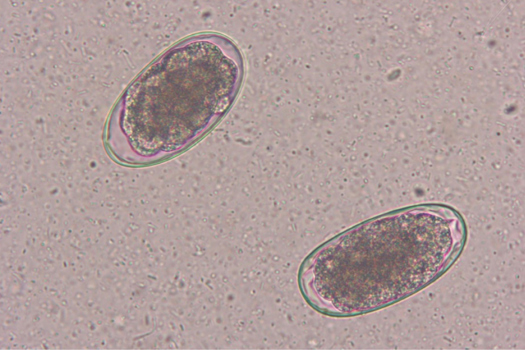 Figure 3. Eggs of hookworms (Ancylostomatidae) detected in stool sample using floatation.