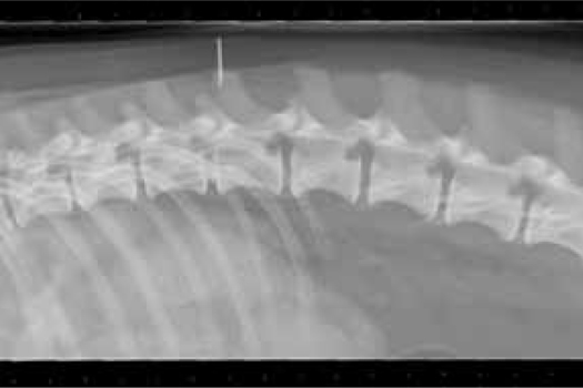 Figure 1. Thoracolumbar radiograph to localise marker pre surgery.